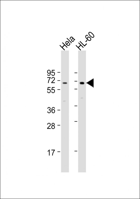 1 - PIGB Antibody (N-term) AP20135a