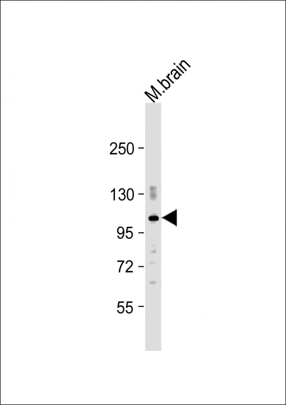 1 - PDE2A Antibody (C-Term) AP22001b