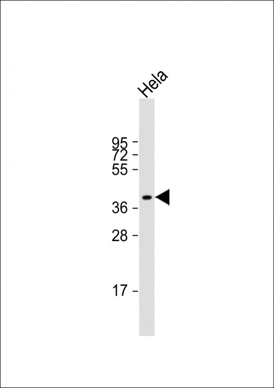 1 - LPGAT1 Antibody (Center) AP22020c