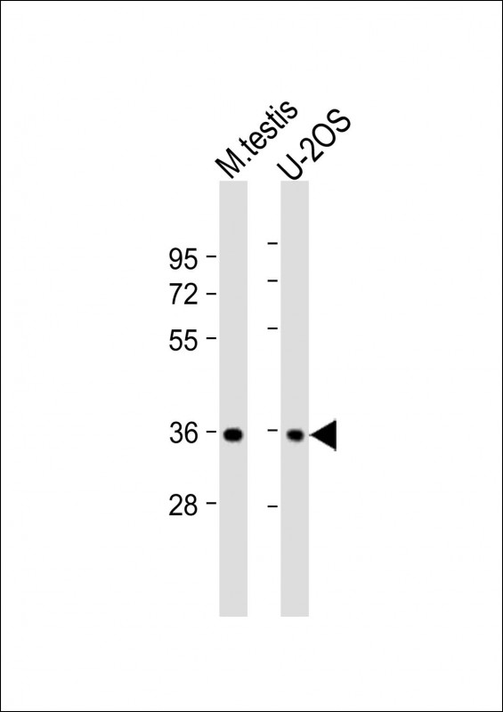 1 - HEXIM2 Antibody (C-Term) AP22031b