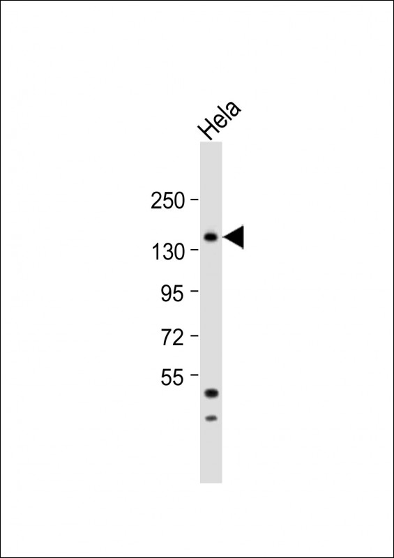1 - MTMR15 Antibody  (N-term) AP5247a