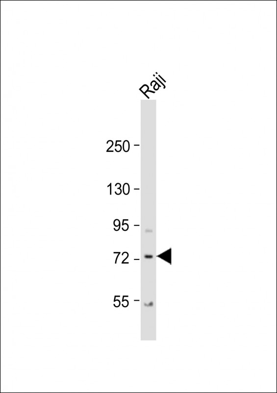 1 - KLHL6 Antibody  (C-term) AP5793b