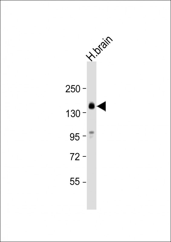 1 - SLC12A5 Antibody (N-term) AP5876a