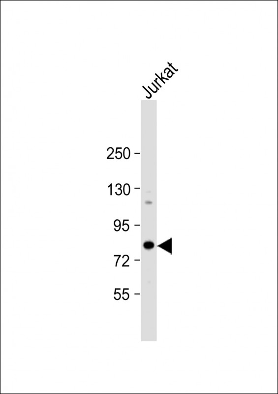 1 - ALKBH8 Antibody (C-term) AP6801b