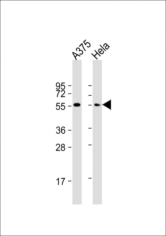 1 - PTRF Antibody (N-term) AP7421a
