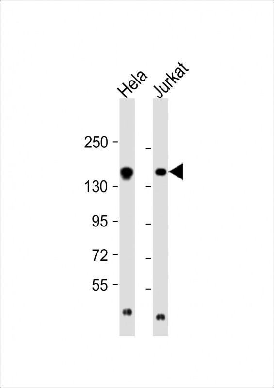 1 - EPRS Antibody (N-term) AP7565a