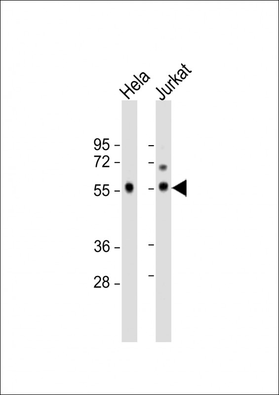 1 - PP5 Antibody (C-term) AP8476b