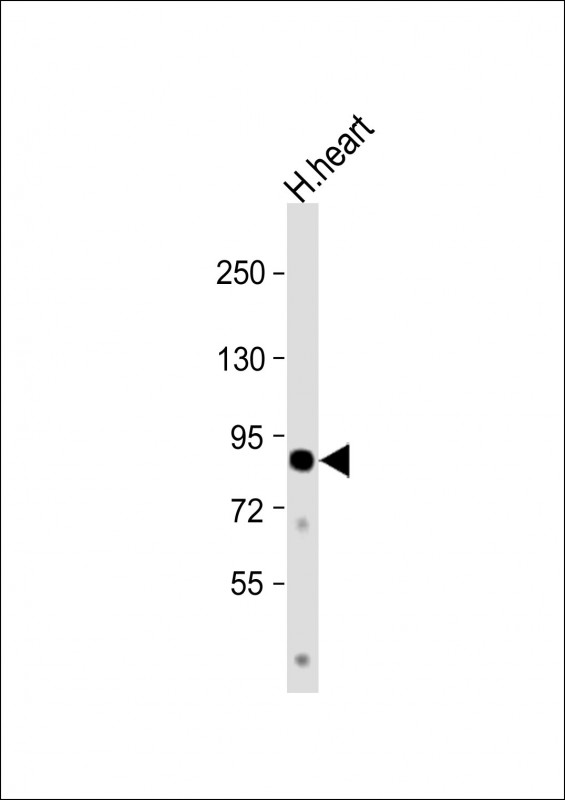 1 - CCHCR1 Antibody (Center) AP8528C