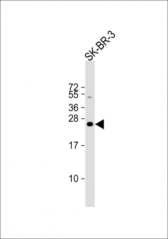 1 - DERL1 Antibody (C-term) AP8745b