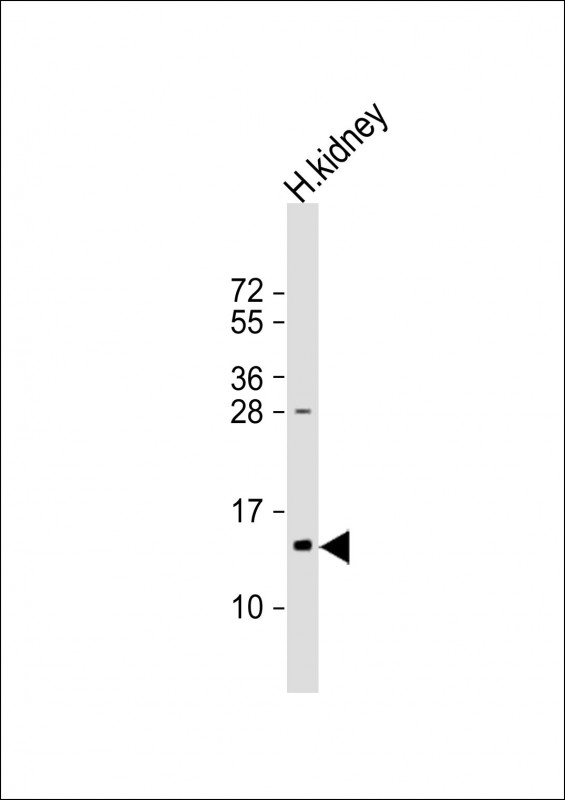 1 - TMIE Antibody (Center) AP9761c