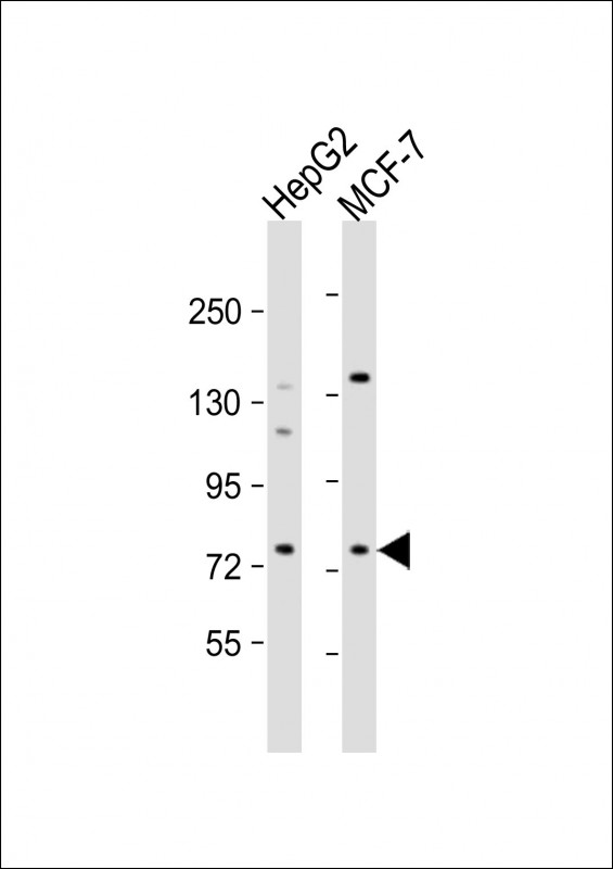 1 - DCP1B Antibody (center) AP9888c