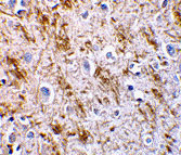 2 - Neurturin Antibody ASC10012