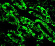 3 - CAD Antibody ASC10036