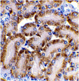 2 - CAD Antibody ASC10036