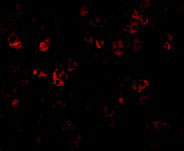 3 - CAD Antibody ASC10037