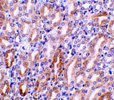 2 - CAD Antibody ASC10037