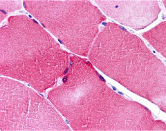2 - ARC Antibody ASC10051