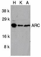 1 - ARC Antibody ASC10051