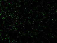 3 - CIDE-A Antibody ASC10052