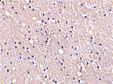 2 - CIDE-A Antibody ASC10052