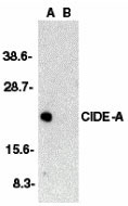 1 - CIDE-A Antibody ASC10052