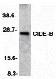 1 - CIDE-B Antibody ASC10054