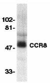 1 - CCR8 Antibody ASC10056