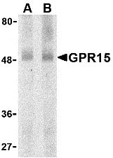 1 - GPR15 Antibody ASC10058
