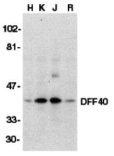1 - DFF40 Antibody ASC10059