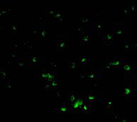 3 - DFF40 Antibody ASC10074