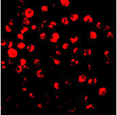 3 - IRAK-2 Antibody ASC10083