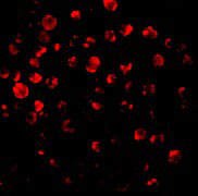 3 - IRAK-2 Antibody ASC10083