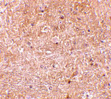 2 - Caspase-13 Antibody ASC10096