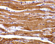 2 - BACE2 Antibody ASC10097