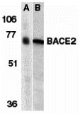 1 - BACE2 Antibody ASC10097