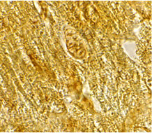 2 - BACE2 Antibody ASC10098