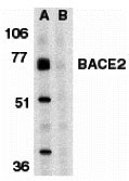1 - BACE2 Antibody ASC10098