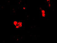 3 - CIDE-B Antibody ASC10115