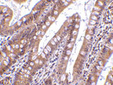 2 - CIDE-B Antibody ASC10115