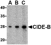 1 - CIDE-B Antibody ASC10115