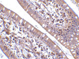2 - CIDE-B Antibody ASC10116