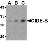 1 - CIDE-B Antibody ASC10116