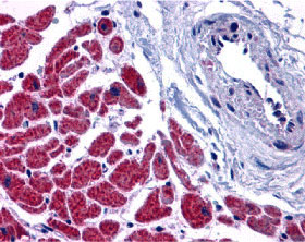 2 - Caspase-12 Antibody ASC10118