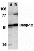 1 - Caspase-12 Antibody ASC10118