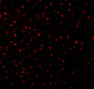 3 - Caspase-12 Antibody ASC10119