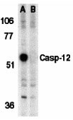 1 - Caspase-12 Antibody ASC10119