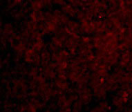 3 - IRAK-M Antibody ASC10127