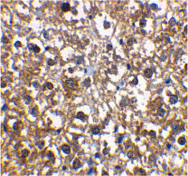2 - IRAK-M Antibody ASC10127