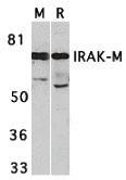 1 - IRAK-M Antibody ASC10127