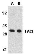 1 - TACI Antibody ASC10130